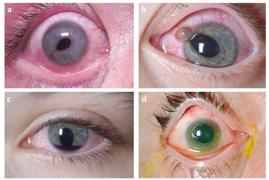 View of Approach to: Ocular trauma