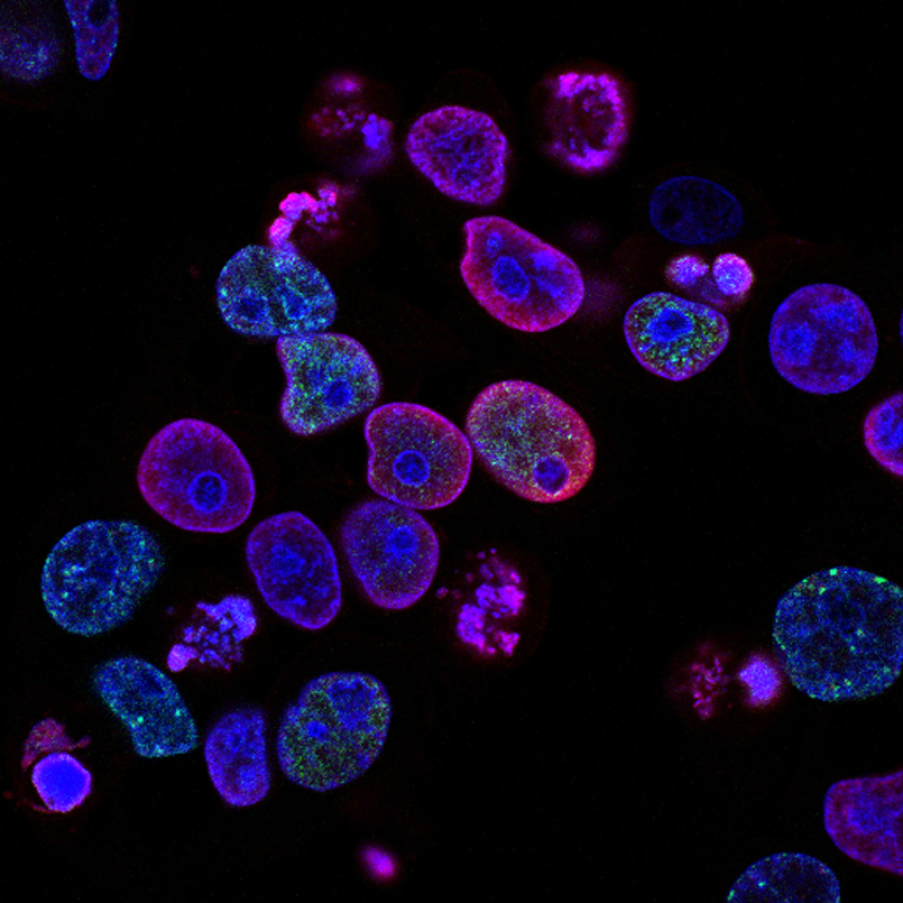 Human colorectal cancer cells