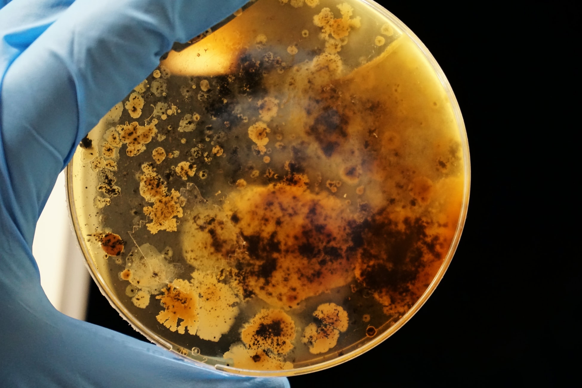 Unsplash - Bacterial colonies grown on an agar plate 